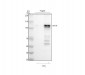 Anti-HIF-1-alpha Rabbit Monoclonal Antibody